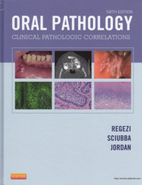 Oral Pathology: Clinical Pathologic Correlations