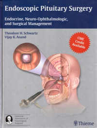 Endoscopic Pituitary Surgery : Endocrine, Neuro-Ophthalmologic, and Surgical Management