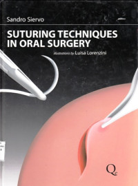 Suturing Techniques in Oral Surgery